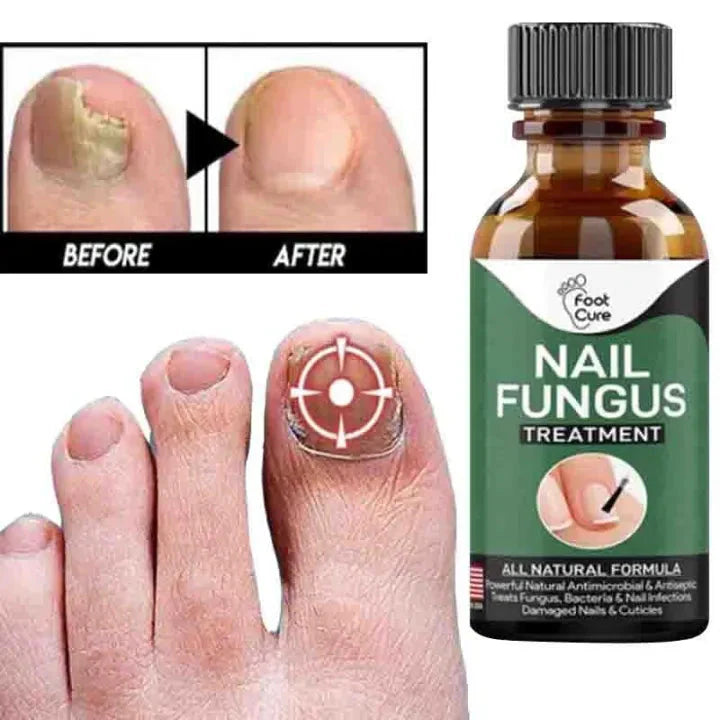 Fast Nail Fungal Treatment Serum